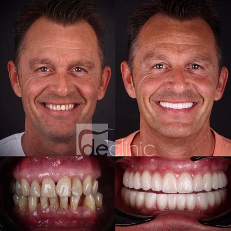 avantsmile dental clinic
